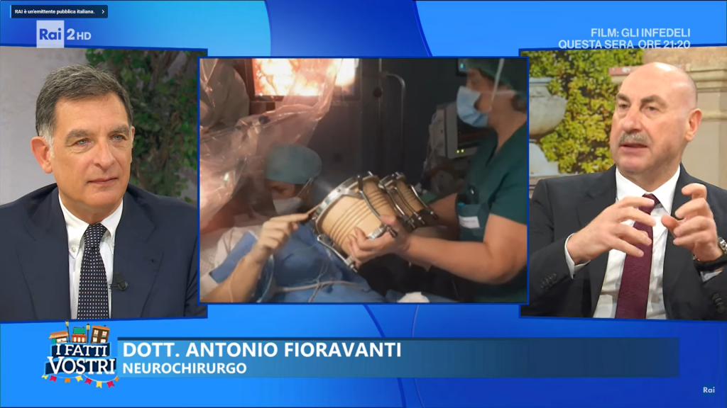 La storia di Sergio raccontata ai fatti vostri - intervento di chirurgia da sveglio del Team di Dr Antonio Fioravanti